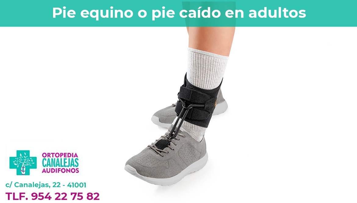 Pie equino o pie ca do en adultos. Problemas y soluciones